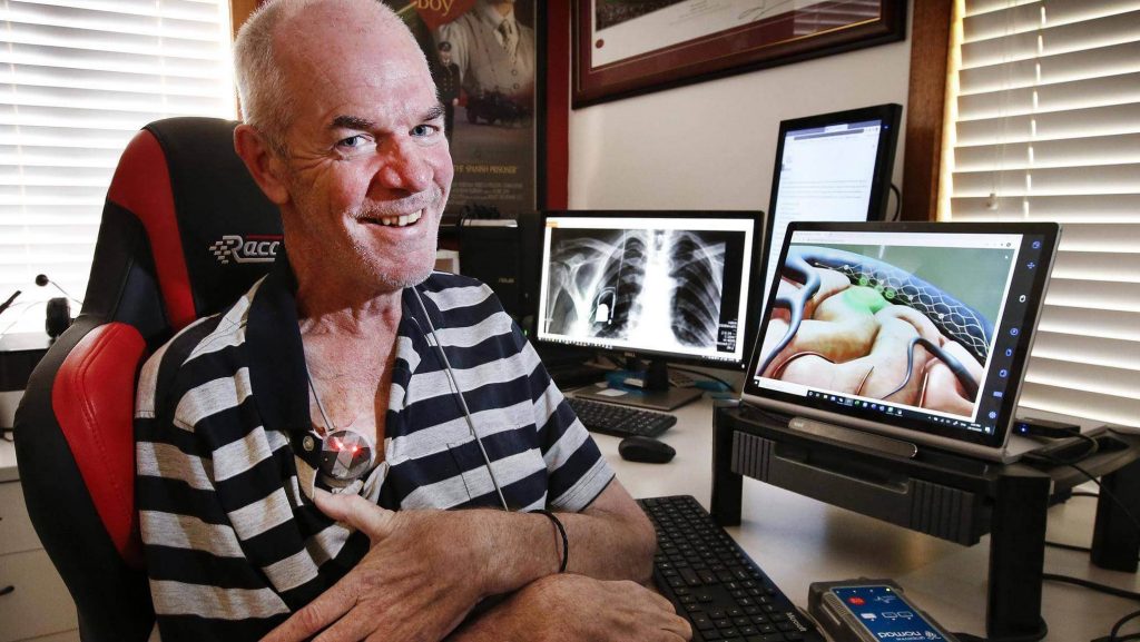 A man with a brain-computer interface implant smiling